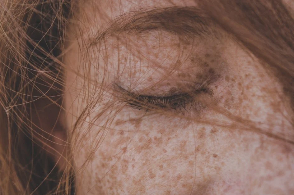 What Causes Dark Spots on Your Face? - how to get rid of dark spots on face naturally