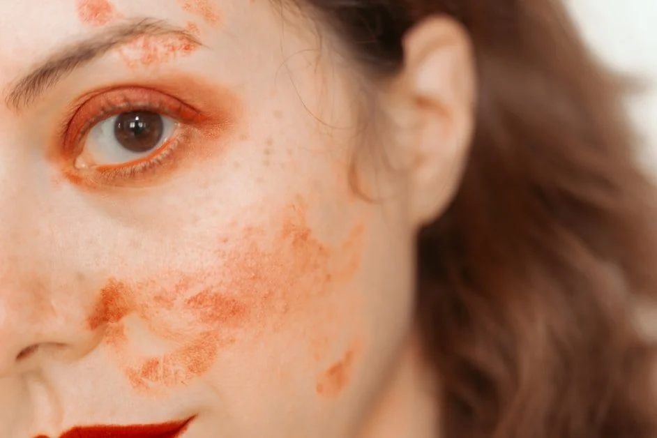 How to Get Rid of Dark Spots on Face Naturally: 7 Proven Methods - how to get rid of dark spots on face naturally