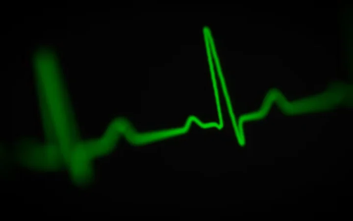 Heart Palpitations in Perimenopause: When to Worry (and When It's Just Hormones)