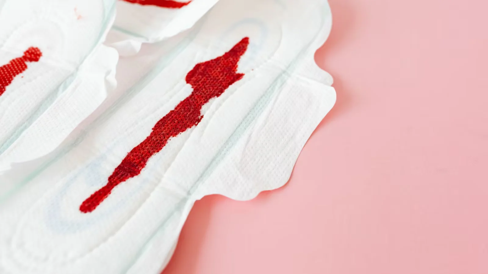 Missed or Irregular Periods That Get Blamed on Stress - low estrogen in your 30s