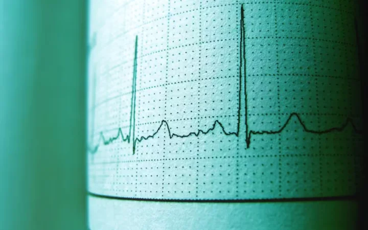 Resting Heart Rate in Perimenopause: What's Normal and What's Not