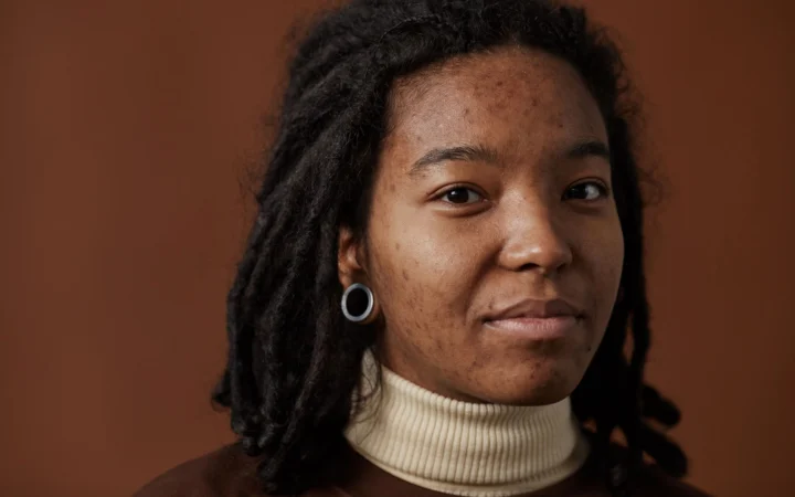 Close-up of a smiling woman with natural hair and visible acne in a studio setting.