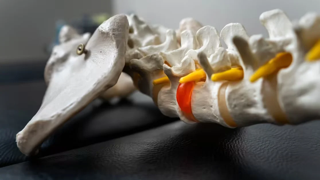 What Causes Herniated Disc Back Pain - herniated disc back pain